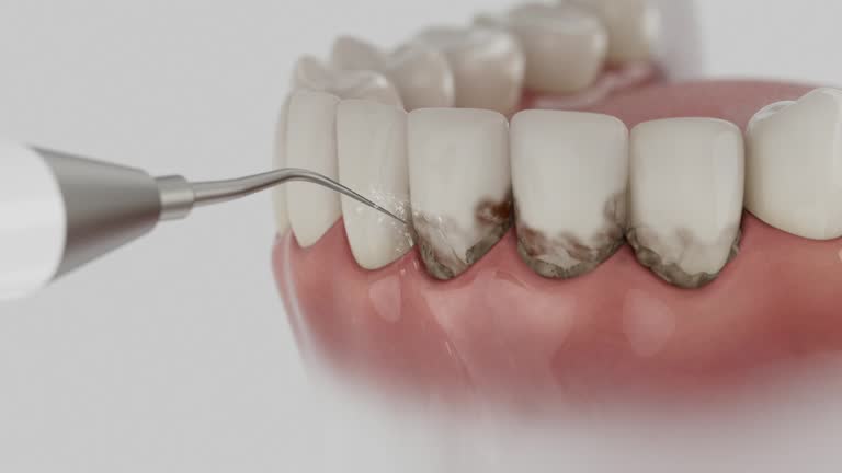 Trusted Invisalign Clear Aligners service in Hasson Heights, PA - Dentist Open Now